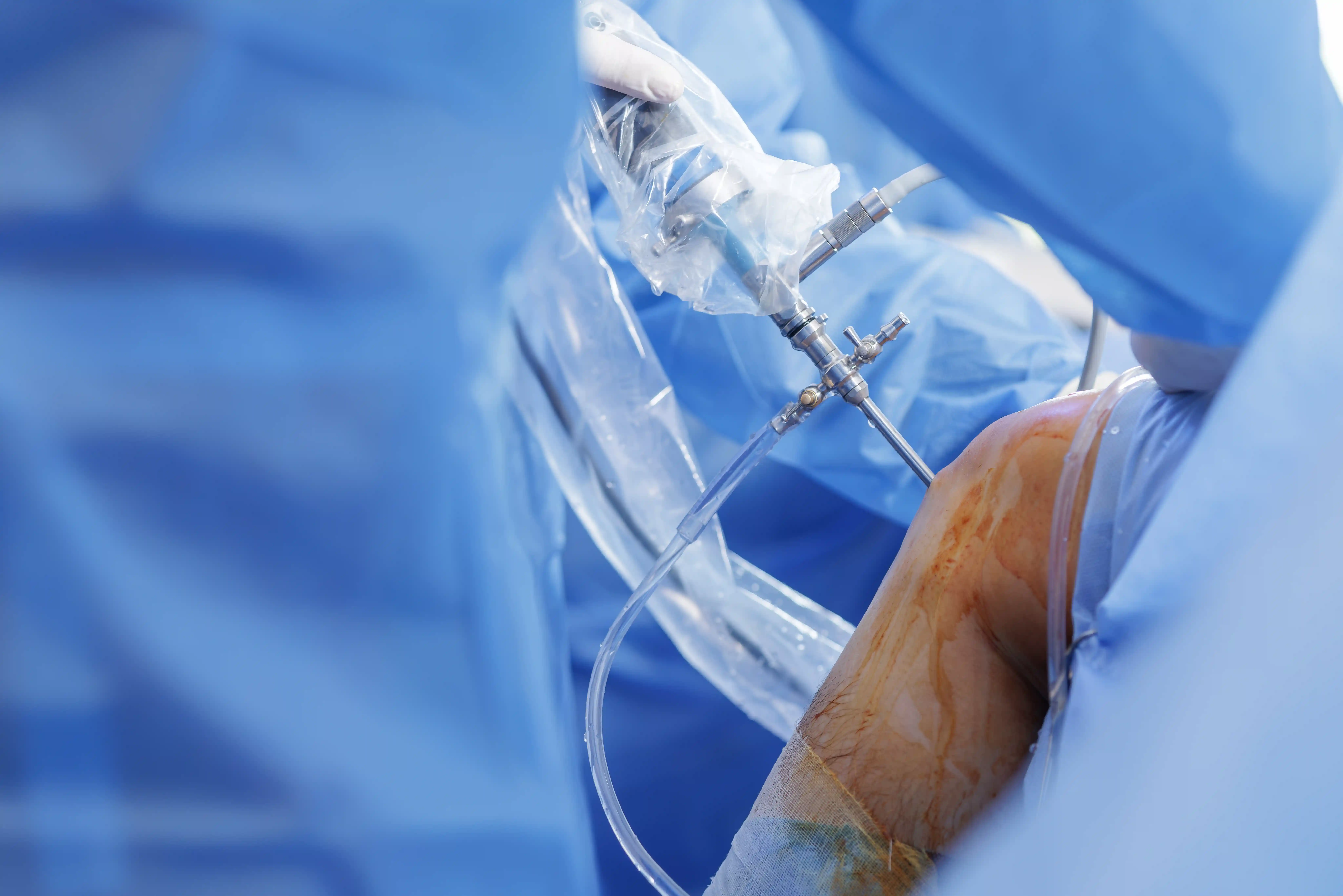 Trauma Orthopaedics