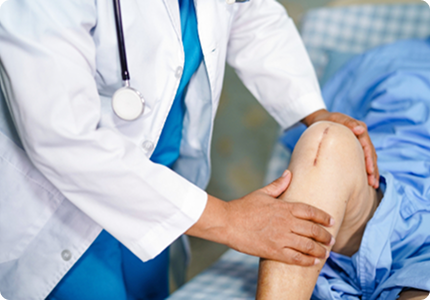 Knee Replacement Surgery